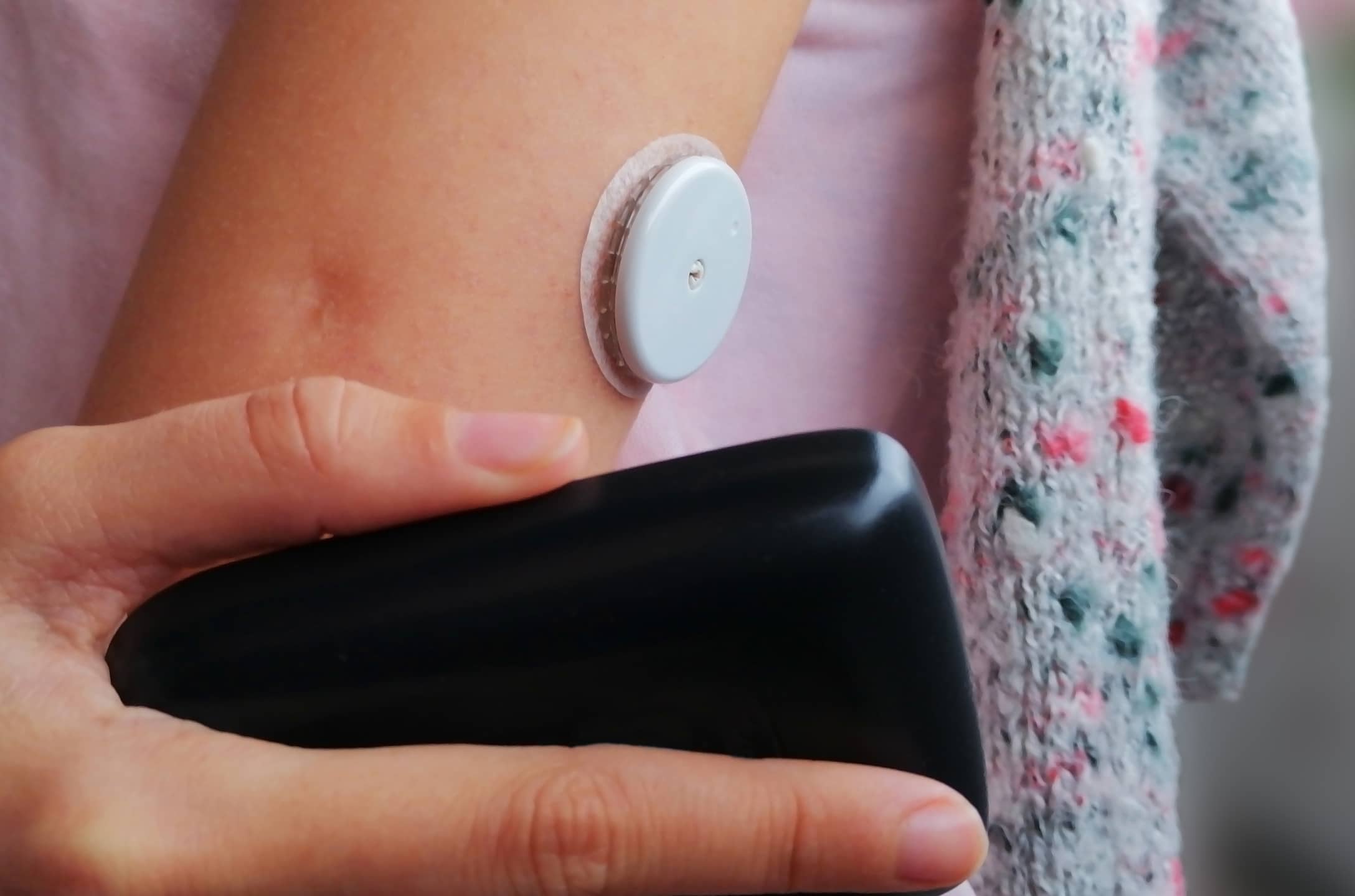 type 1 diabetes and eating disorder recovery
